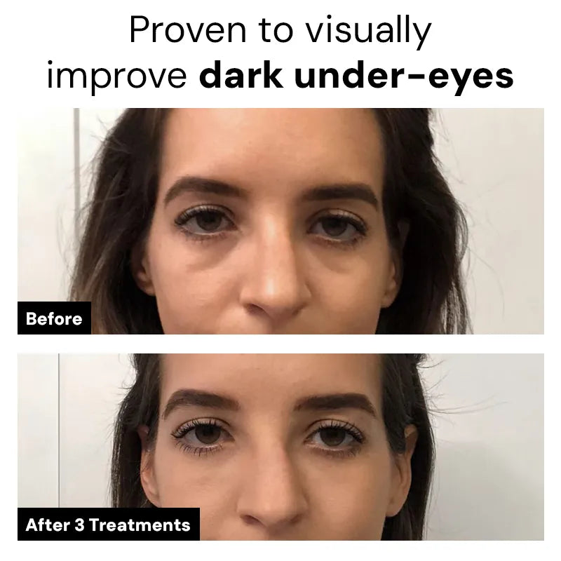 Dr.Meladra™ Micro infusion Patches