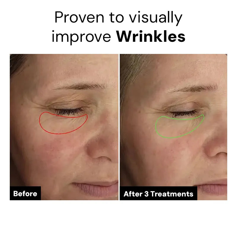 Dr.Meladra™ Micro infusion Patches