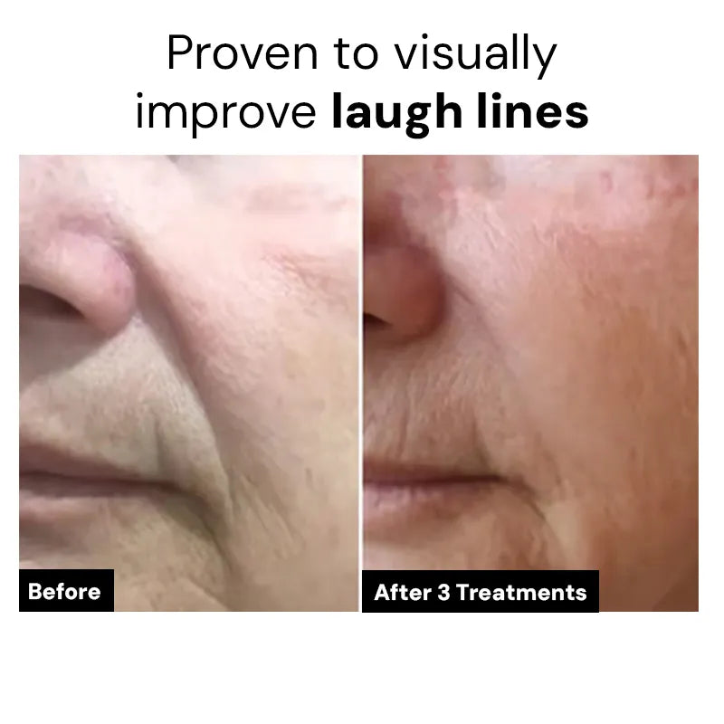 Dr.Meladra™ Micro infusion Patches