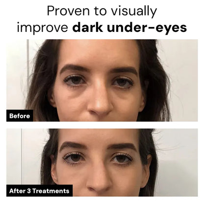Dr.Meladra™ Micro infusion Patches